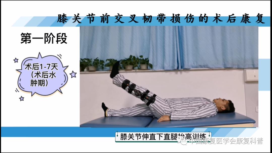 膝关节前交叉韧带损伤的术后康复