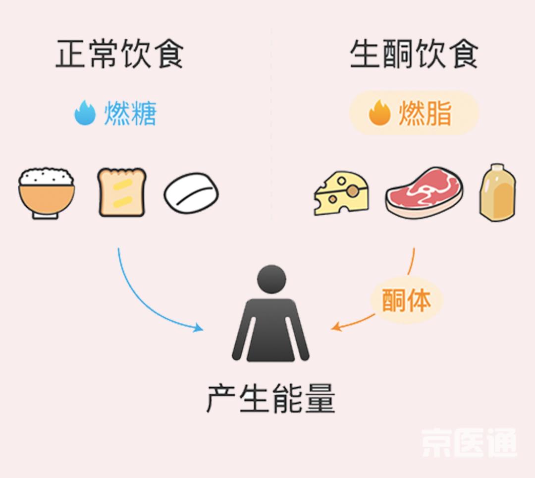 减肥神速的"生酮饮食"靠谱吗?医生:更适合这些人