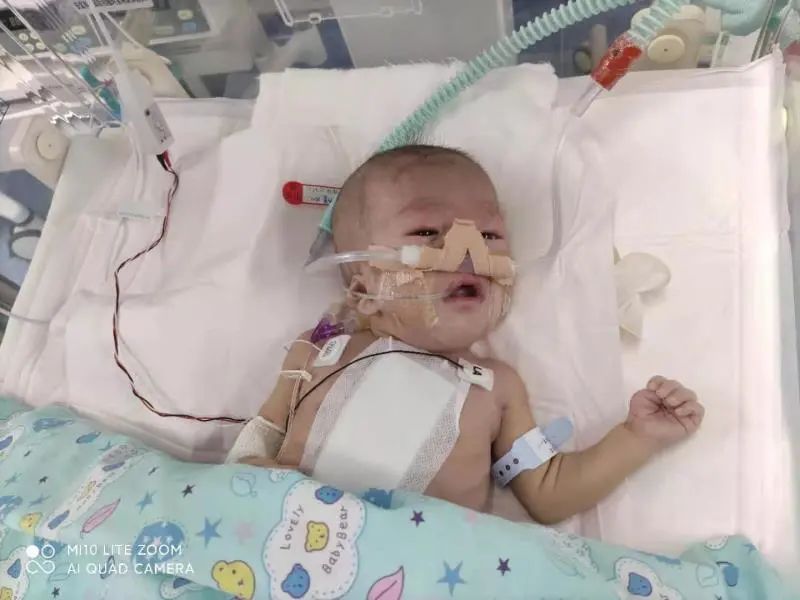 4个月患儿乘高铁赴京治疗最新进展:持续呼吸机辅助呼吸,正全力救治