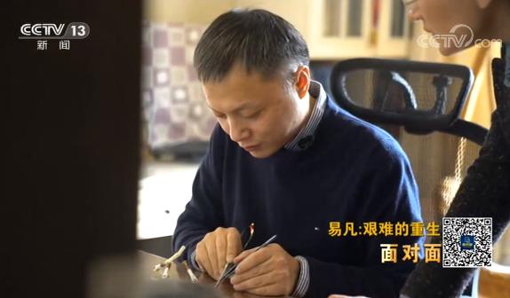 黑脸医生易凡病愈之后最想干的一件事是到北京中日友好医院看看抢救过