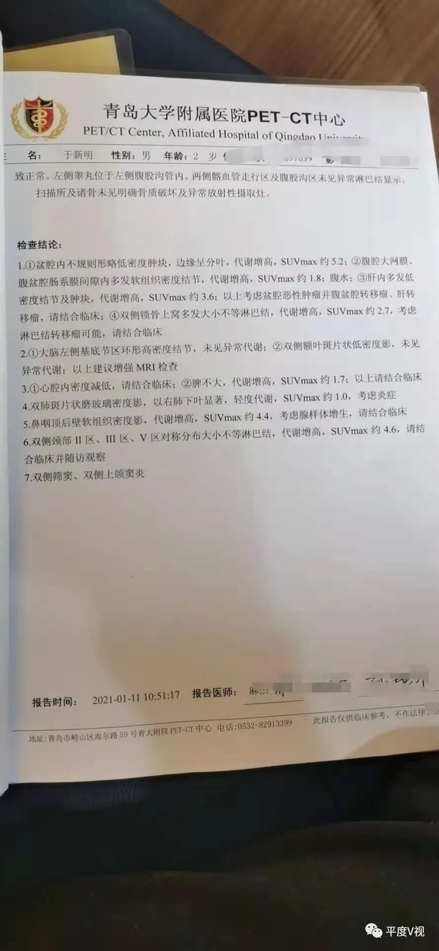 确诊恶性肿瘤青岛两岁男童今天第一次化疗看到检查结论爸爸腿都软了