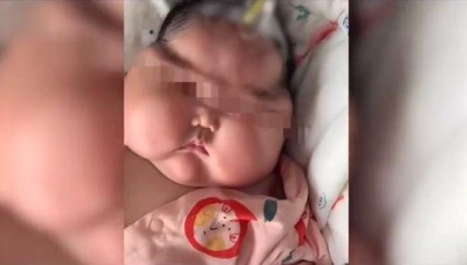 婴儿使用抑菌霜后成"大头娃娃"?下架!调查!