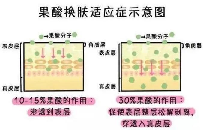 关于果酸换肤这些是你不知道的事