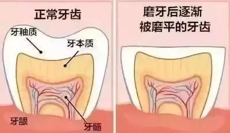 "深夜听到磨牙怪声, 就因为孩子肚里有虫?