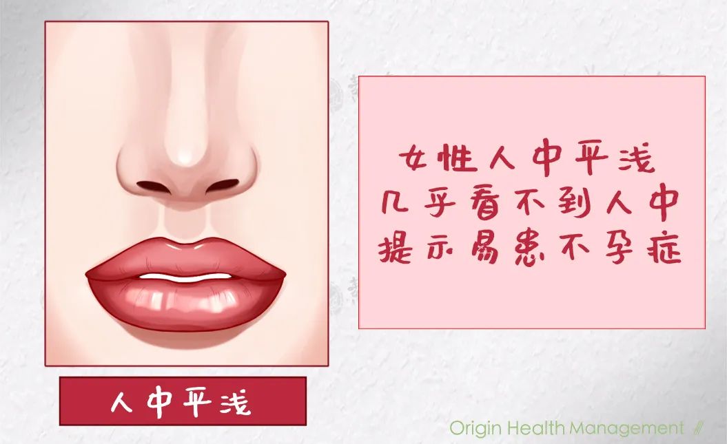 5,中年女性人中有明显的横纹穿过或"十"字纹 多提示此人操劳过度