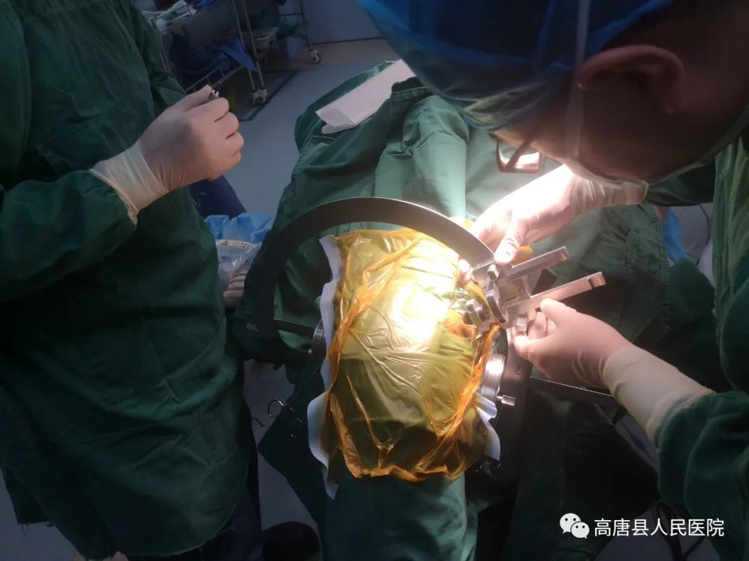 高唐县人民医院神经外科突破"手术禁区",给脑干病变