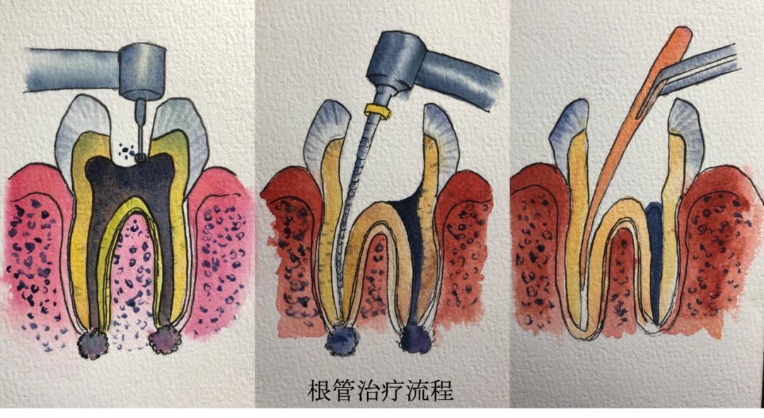 【健康百科】揭开"抽牙神经"的神秘面纱