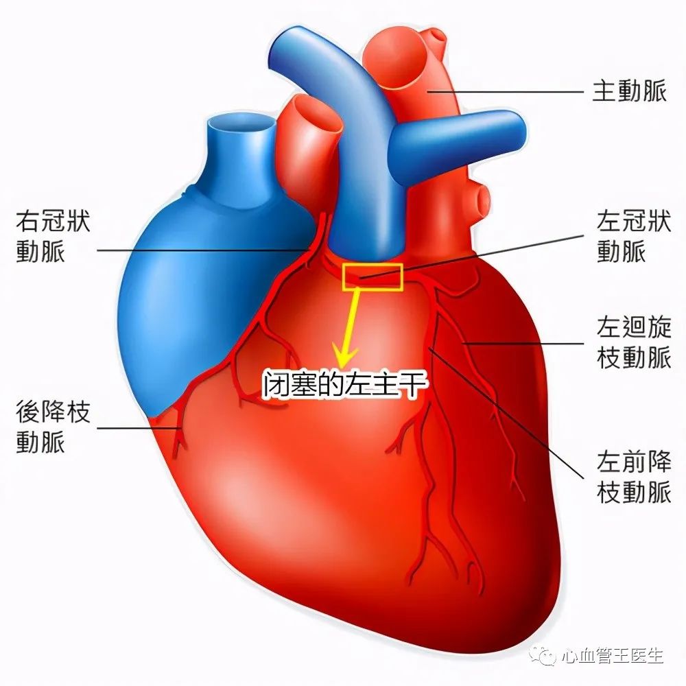 心脏三个大血管,52岁男子两个血管都丢失,手术台上心脏停跳