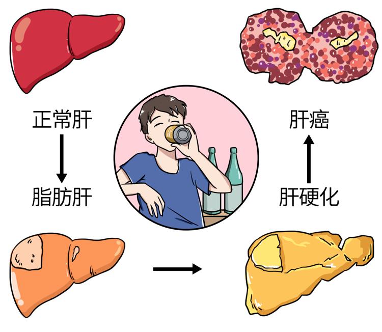 吴孟达从确诊肝癌到病逝不到3个月为何肝癌一发现就是晚期