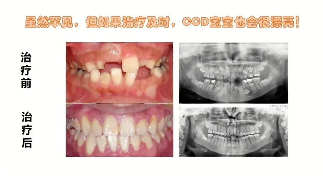 【科普知识】口腔罕见病知多少