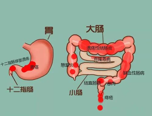 邮医61科普不要把便血当小事喔