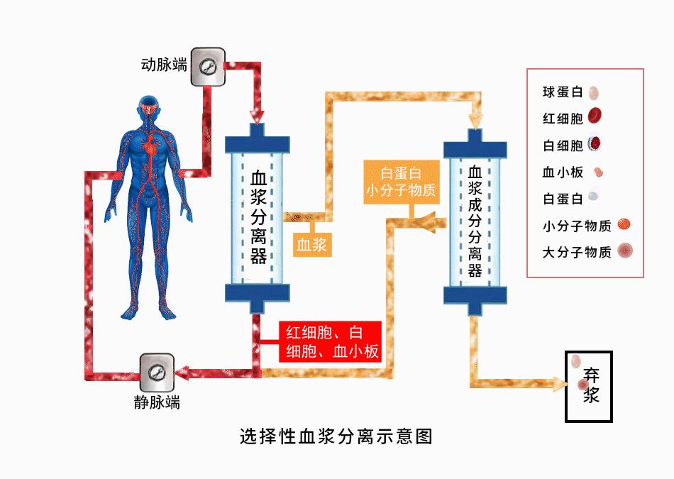 即经大孔径血浆分离器分离出的血浆再通过膜孔径更小的血浆成分分离器