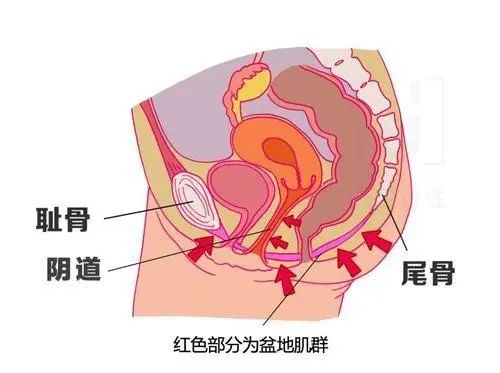 女性尿失禁,尴尬