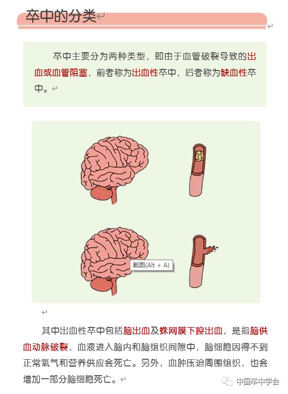 爱脑行动系列科普卒中疾病有哪些类型