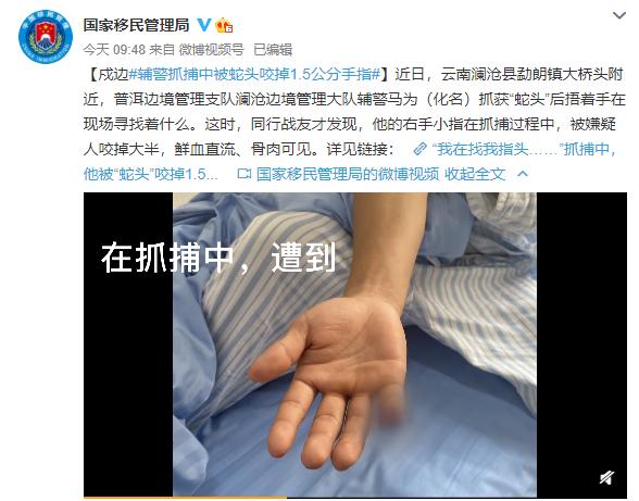 云南辅警抓偷渡蛇头被咬断手指,但他说还会冲_媒体