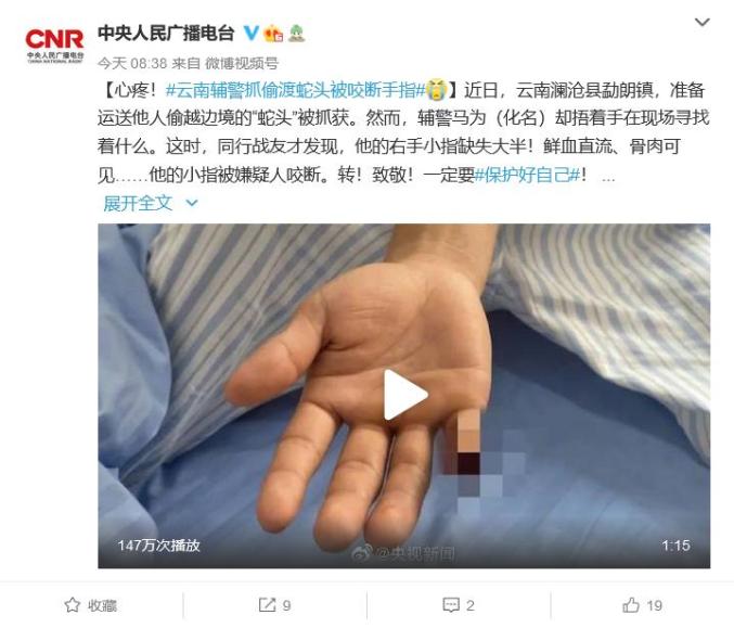 为抓住偷渡者云南一辅警手指头被生生咬断