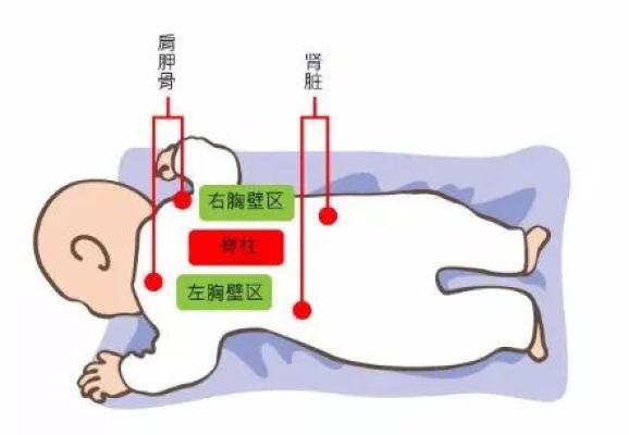 丨肿瘤卫士丨肺癌后伴有感染拍背排痰促进健康