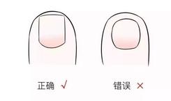 男子剪脚趾甲破了皮竟要截肢医生全球每20秒就有一例