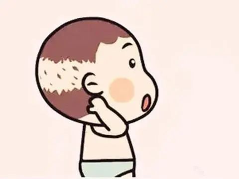 人家还是个宝宝,怎么也"秃"了?