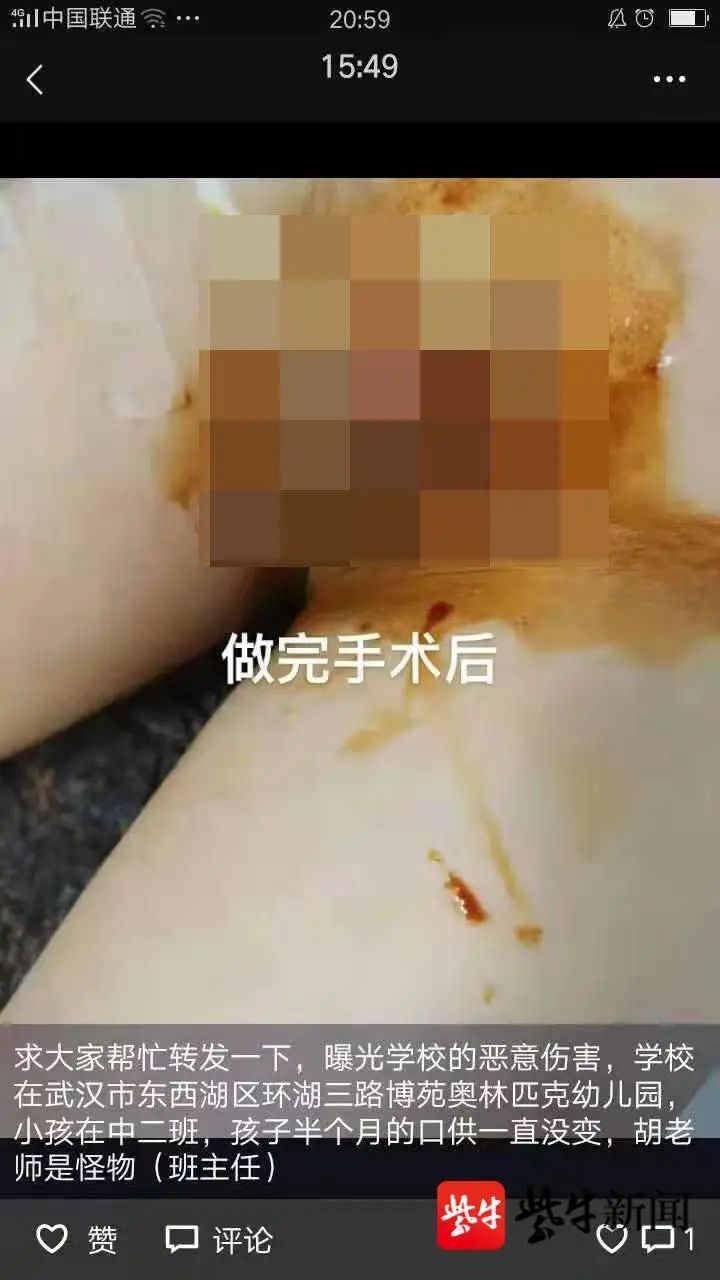 男童称生殖器遭“幼儿园‘怪物’老师”剪断?教育局回应(最新发布)