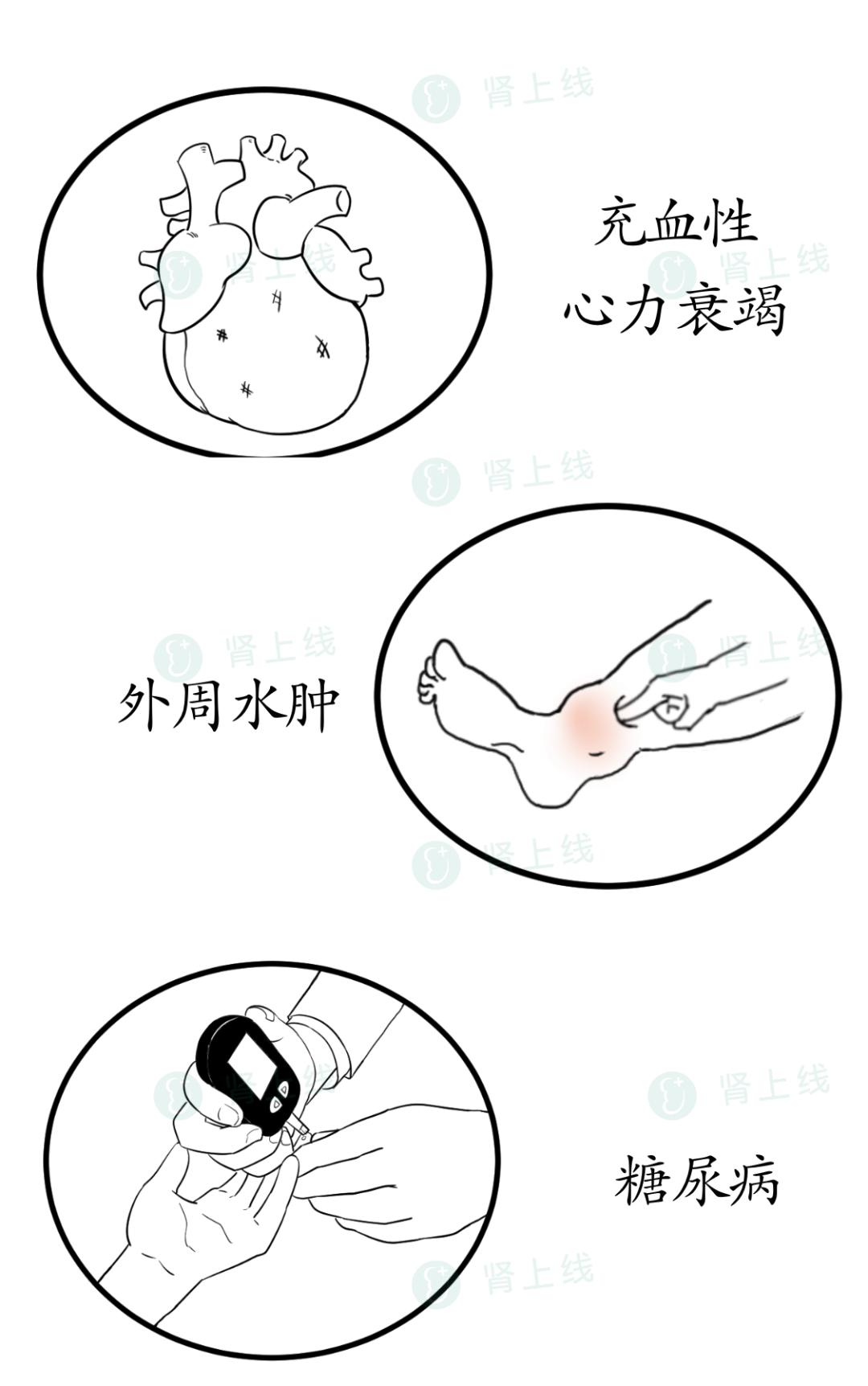 夜尿多不一定是肾不好,肾科医生告诉你常见的5大原因