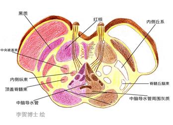 图1:中脑解剖 今天与大家分享的这个中脑梗死病例,除常见的眼外肌