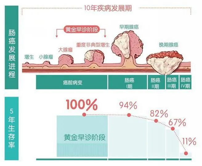 如何让中晚期肠癌患者,生存时间超过五年?