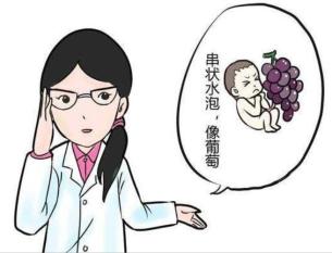 我的宝宝是葡萄葡萄胎