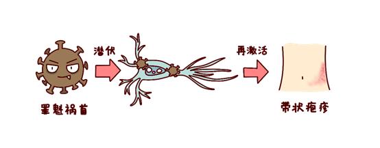 揭开带状疱疹传说中的面纱