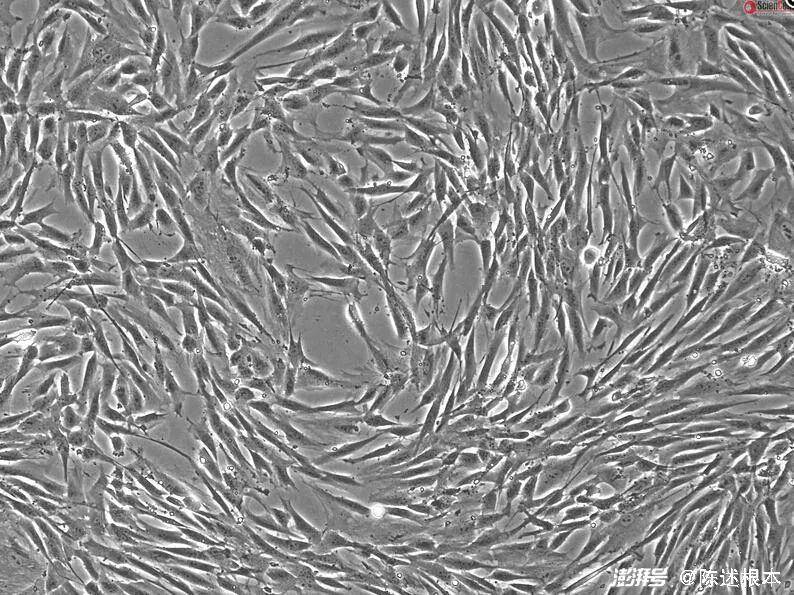 成纤维细胞的三种亚群,源于同一个祖先
