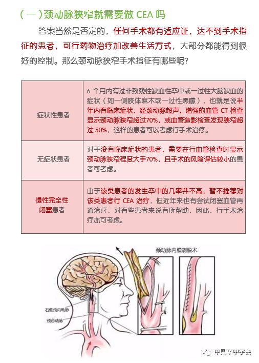 【爱脑行动系列科普】颈动脉斑块可以用颈动脉内膜剥脱术(cea)切除吗?