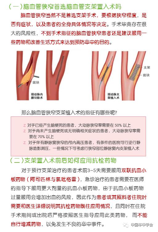 【爱脑行动系列科普】什么样的脑血管狭窄适合用支架植入术?