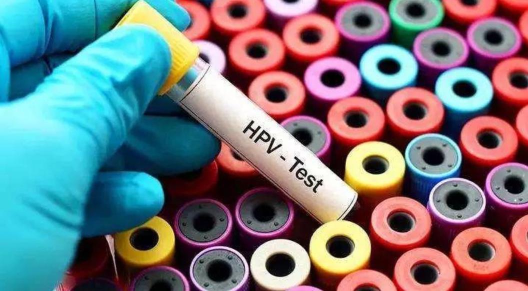 no,no,no, hpv≠hiv,今天我们就来彻底了解一下两者之间的区别.