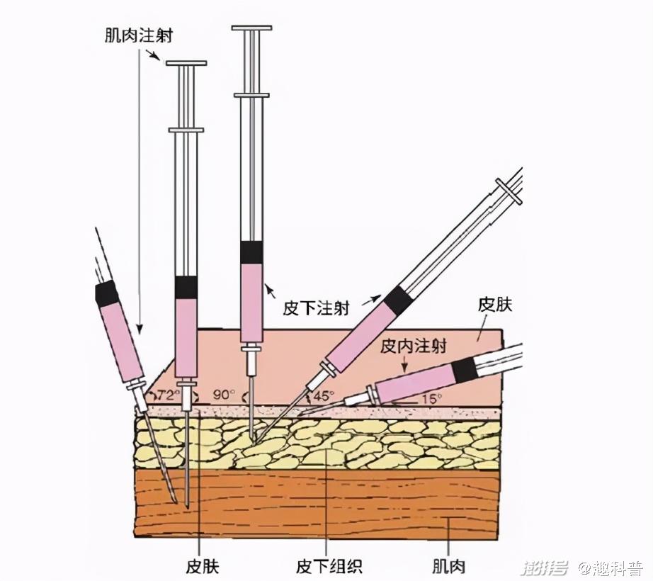 为什么你从来没有质疑过疫苗总是打在胳膊上