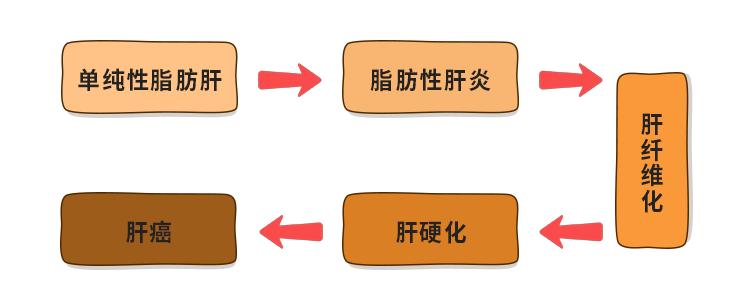 从脂肪肝到肝癌其实只要5步