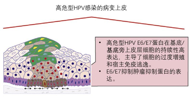 鹿角兔的传说你听说过吗低危型hpv那点事儿