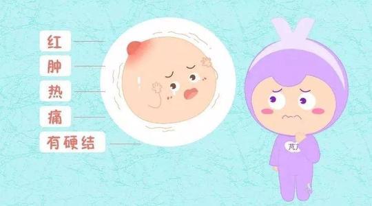 有乳房奶结怎么办?宝妈看过来,金山医院中医科有妙招