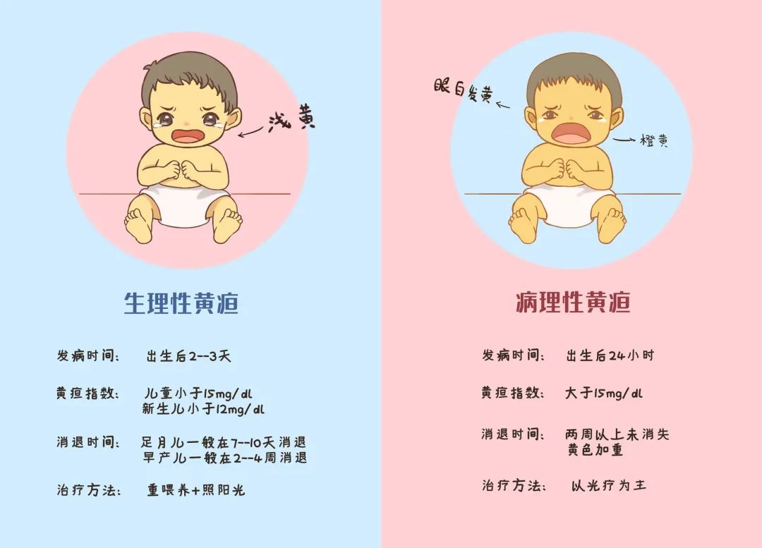 严重黄疸的宝宝全身的症状比较明显,可以表现吃