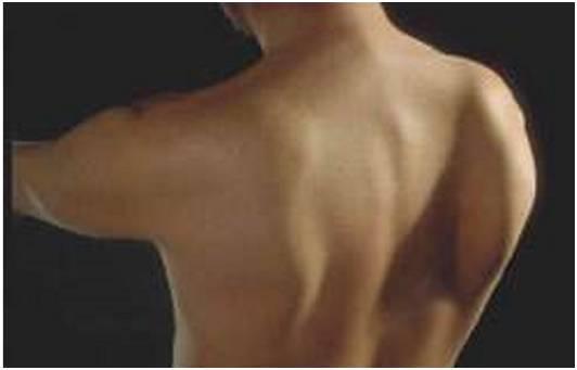似乎是女性背部性感的体现,后背两块突起的肩胛骨如同翅膀一般,美背香