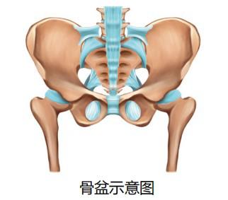 产后体态问题骨盆倾斜怎么办