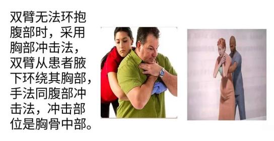 行动 救在身边"志愿服务项目—心脏骤停救生技术 气道异物梗阻急救法