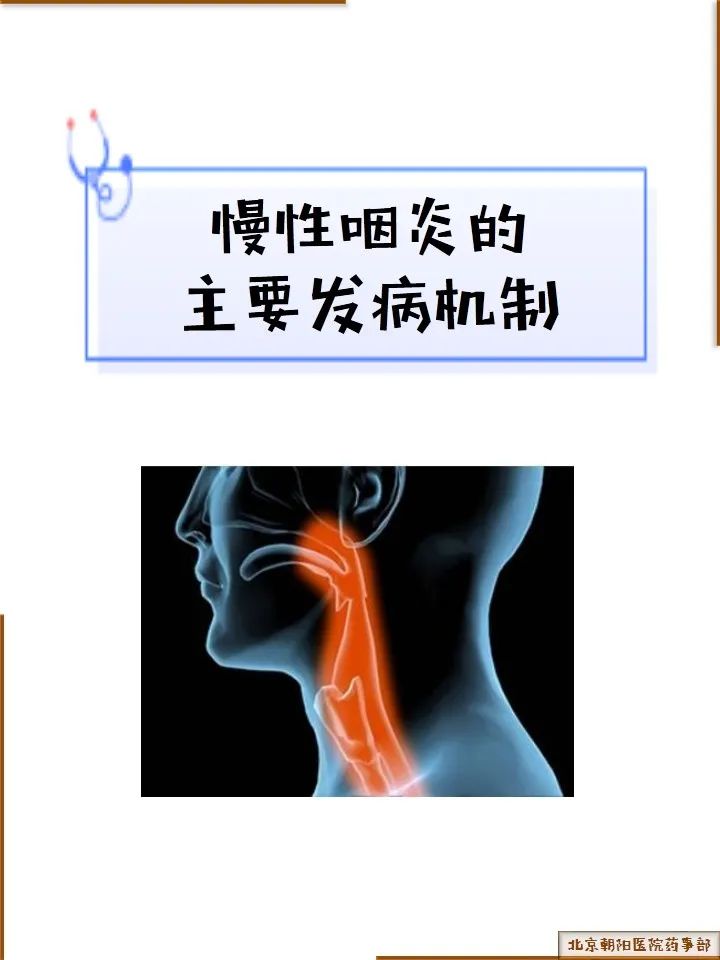 慢性咽炎的治疗和预防