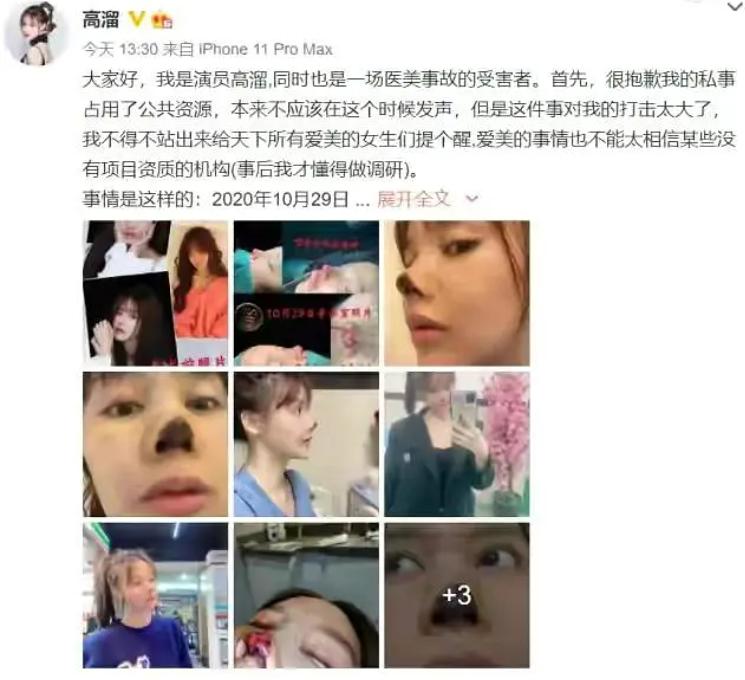 女网红抽脂感染去世美不止一种不要因为他人的恶意伤害自己的身体