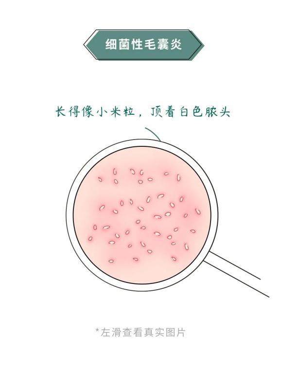 澎湃新闻客户端