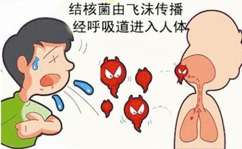除了肺,这些部位也会得结核