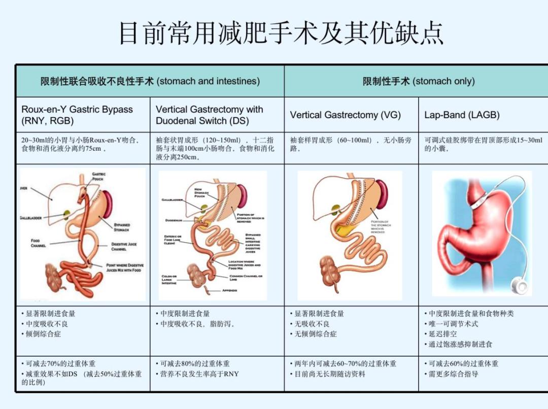 浦人医技术减重新希望我院开展腹腔镜减重代谢手术