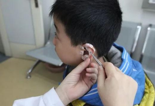 【科普】青少年近视?这份中医指南收好