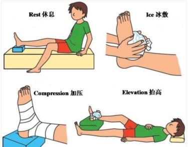 如果你不小心发生了脚踝扭伤,又肿又痛,一定要做出应急处理,牢记rice