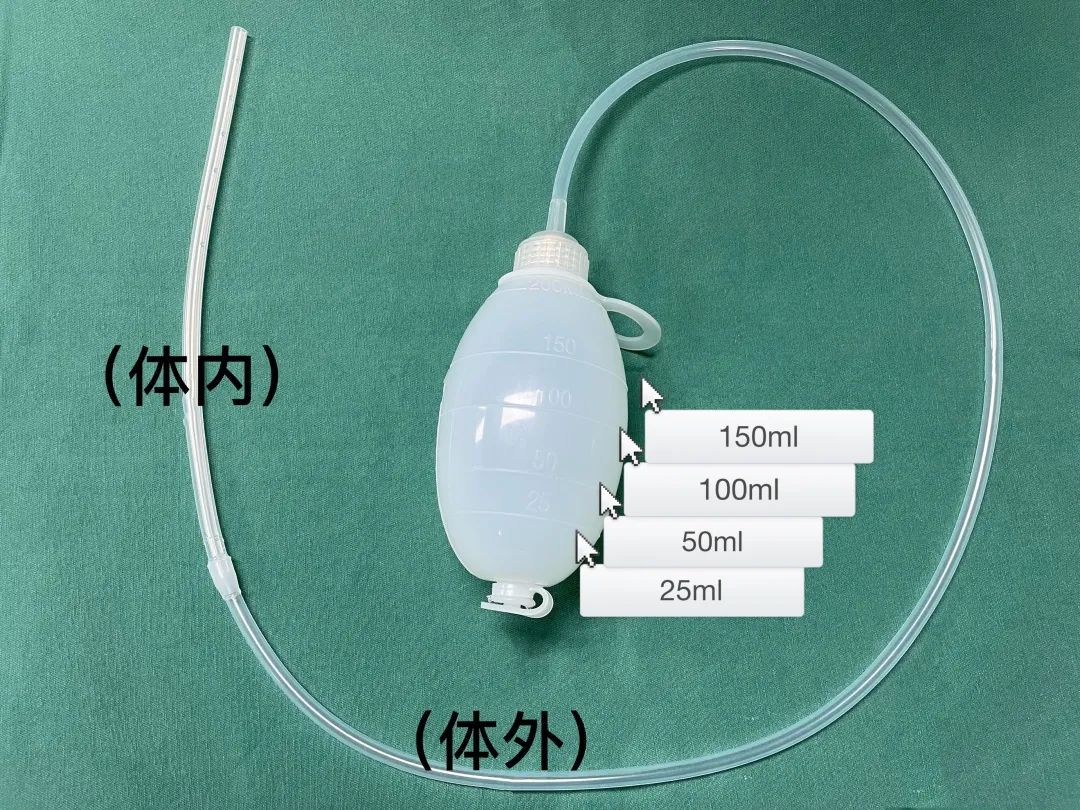 负压球绝不可以自行拔出或牵拉;起身的时候要小心,可以将负压球用固定