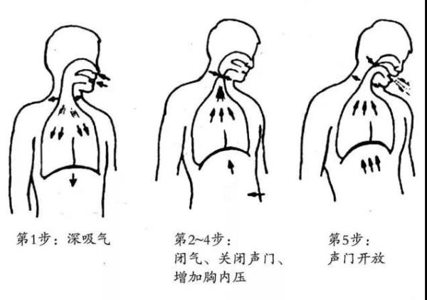 有效咳嗽咳痰,可以帮助患者清除痰液,减少肺部感染.